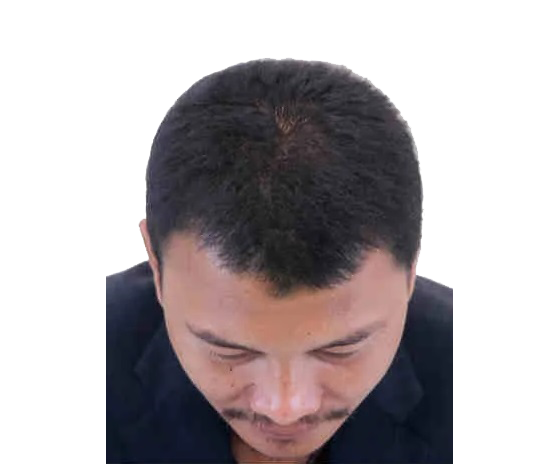 Image title
